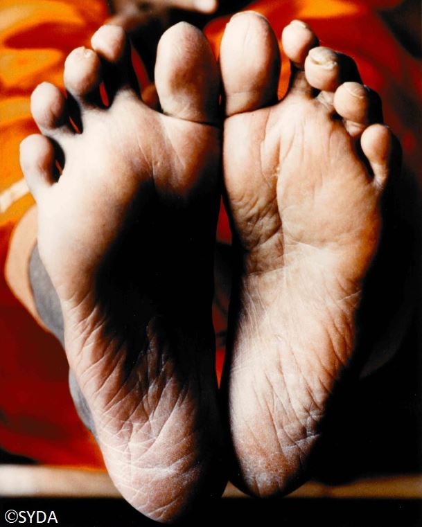 Close up photo of the bottom of baba's feet